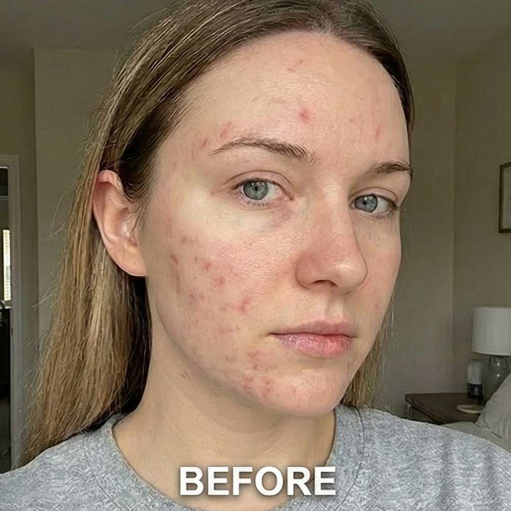 Before Serum